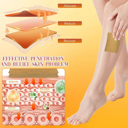 Turmeric Varicose Vein Patches – FLAT 50% OFF | Natural Relief & Healing